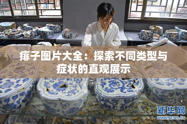 痱子图片大全：探索不同类型与症状的直观展示