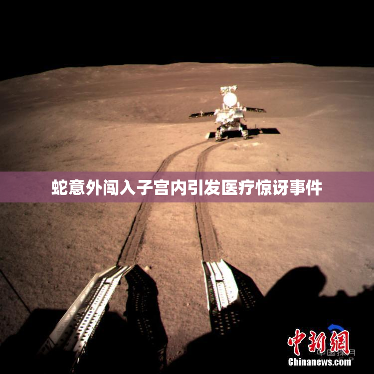 蛇意外闯入子宫内引发医疗惊讶事件