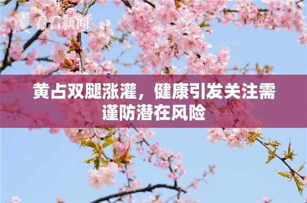 黄占双腿涨灌，健康引发关注需谨防潜在风险