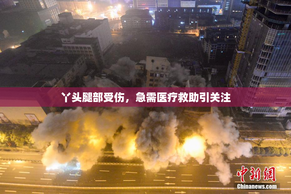 丫头腿部受伤，急需医疗救助引关注