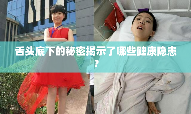 舌头底下的秘密揭示了哪些健康隐患？