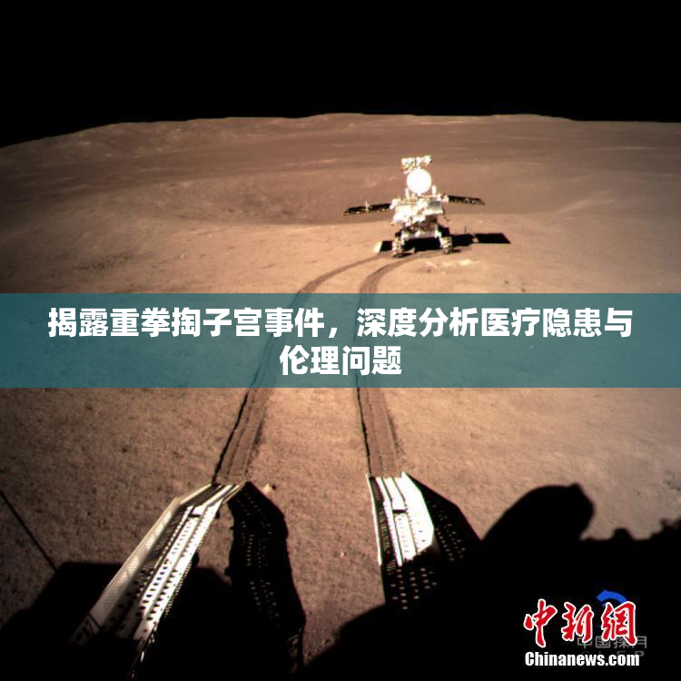 揭露重拳掏子宫事件，深度分析医疗隐患与伦理问题