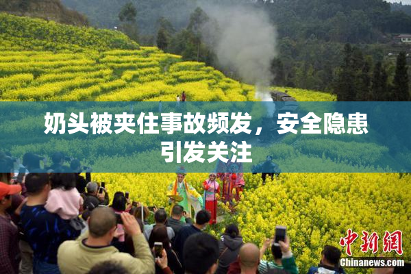 奶头被夹住事故频发，安全隐患引发关注