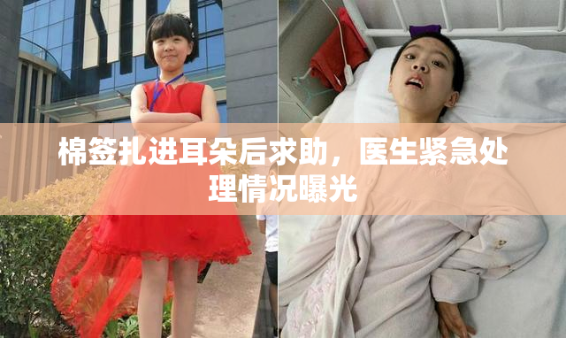 棉签扎进耳朵后求助，医生紧急处理情况曝光