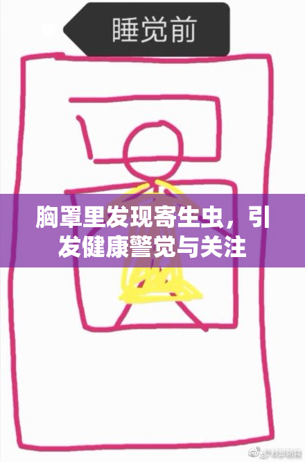 胸罩里发现寄生虫，引发健康警觉与关注