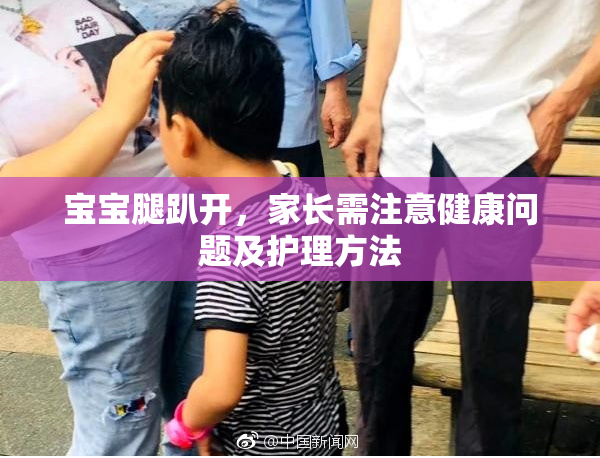 宝宝腿趴开，家长需注意健康问题及护理方法