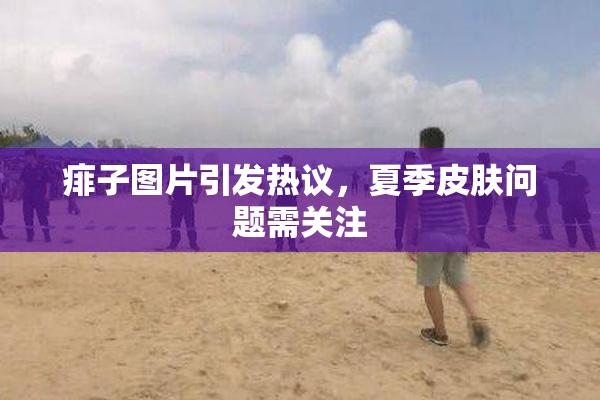 痱子图片引发热议，夏季皮肤问题需关注